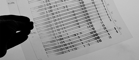 Epidemiological Studies